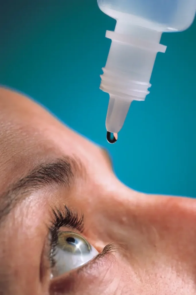 aftercare for glaucoma treatment