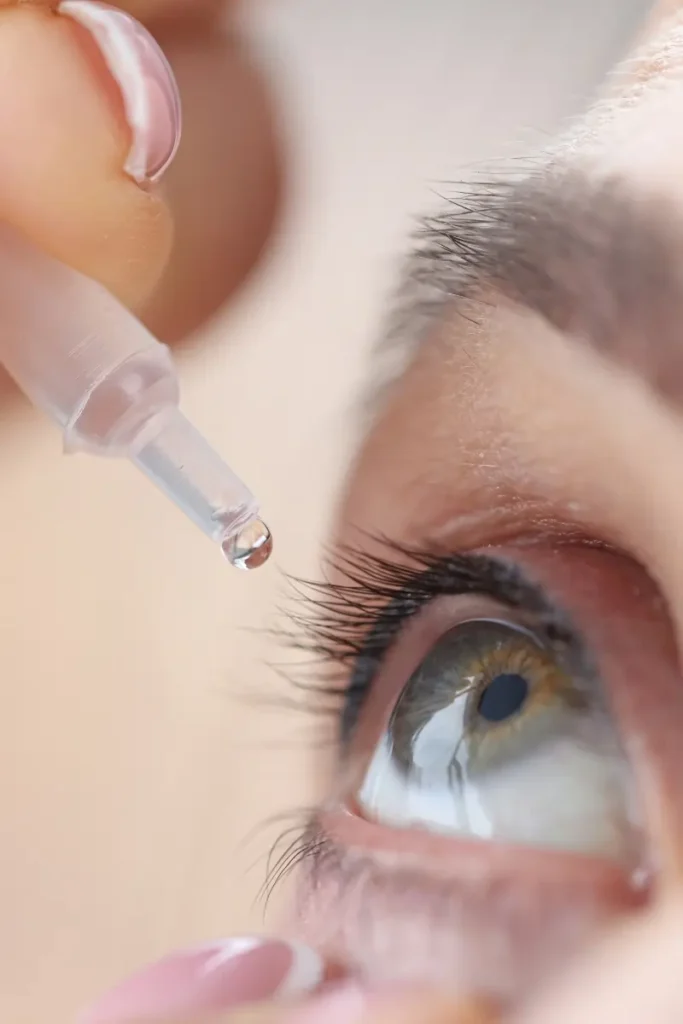 AFTERCARE AFTER REFRACTIVE SURGERY