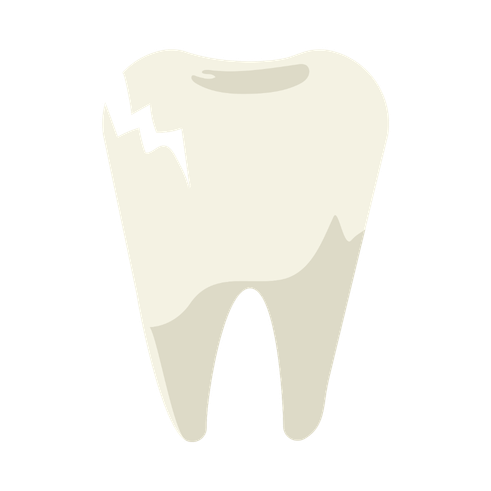 Cracked or Fractured Tooth