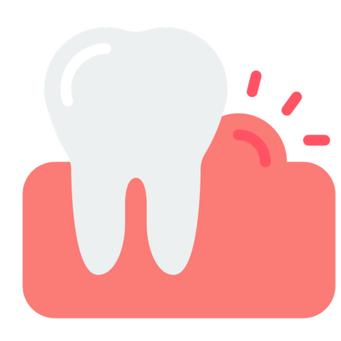 Severe Gum Disease