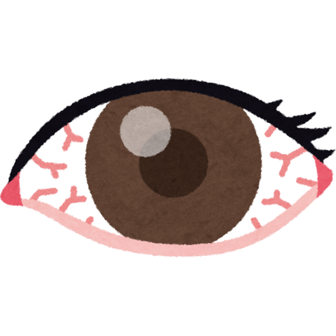 Elevated Eye Pressure