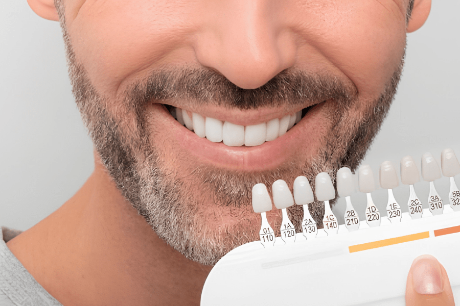 Are You a Suitable Candidate for Dental Veneers?
