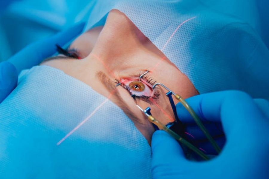 What is LASIK Eye Surgery?