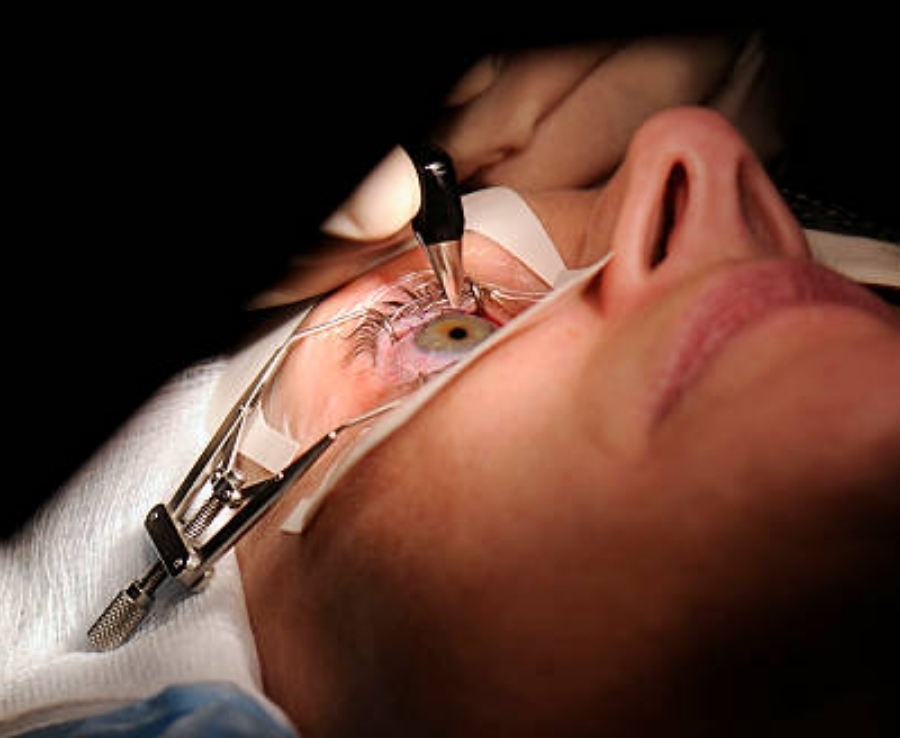 Advanced LASIK Treatment Offered