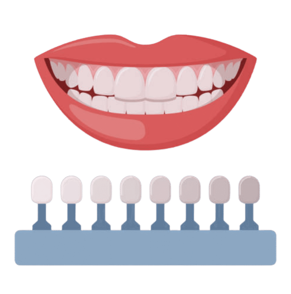 What Are Dental Veneers?