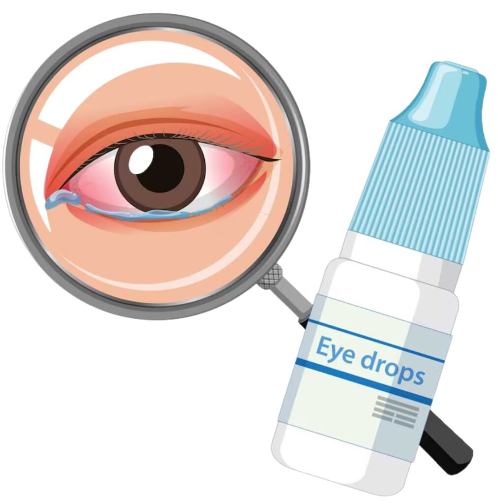 What is Dry Eye Syndrome?