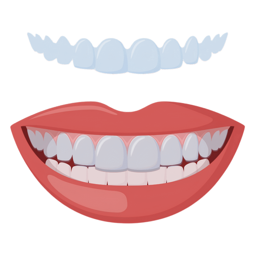 What Are Invisible Braces?